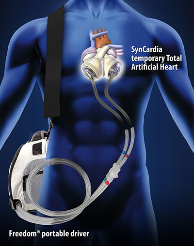 total artificial heart