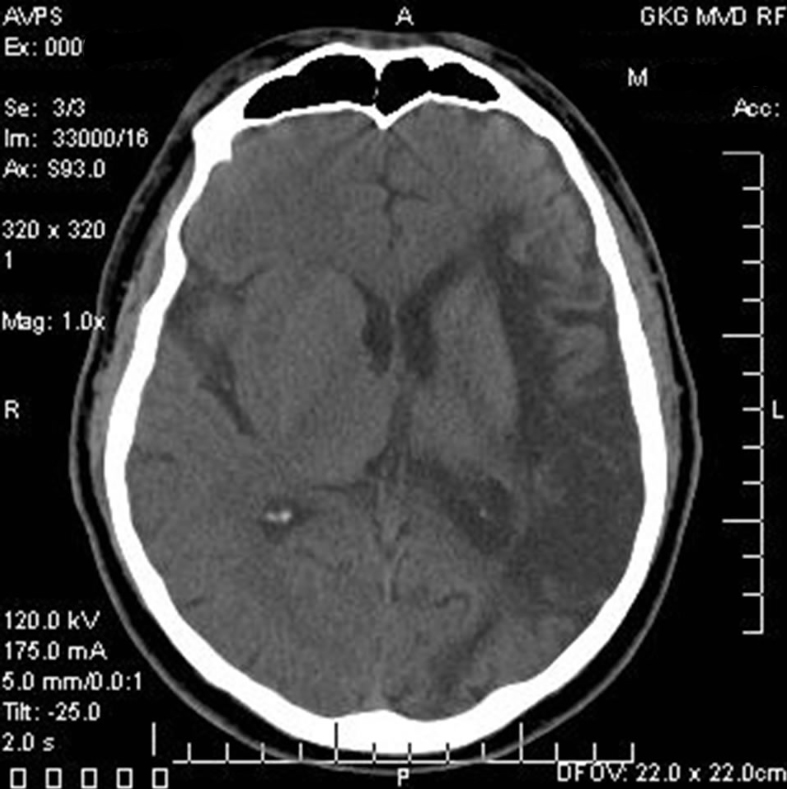 MobileStrokeTreatmentUnit_MockUp