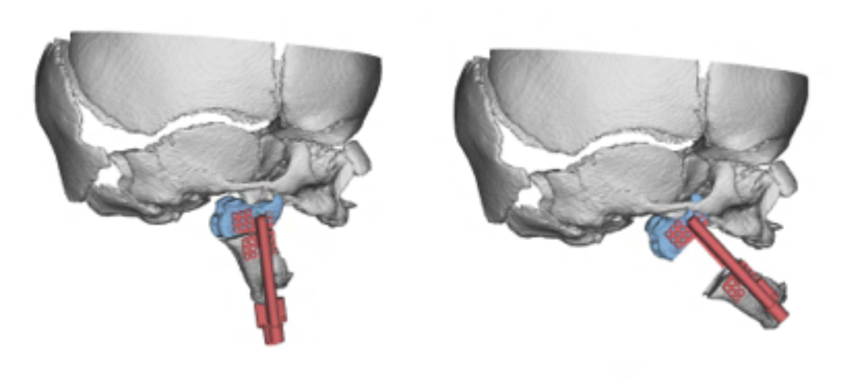 Medical Modeling