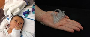 Materialise's 3D printed HeartPrint services
